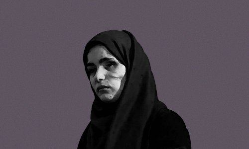 "بعد الإصابة أصبح ينظر إليّ باشمئزاز"... غزيات بوجوه مشوهة يحكين قصصهن