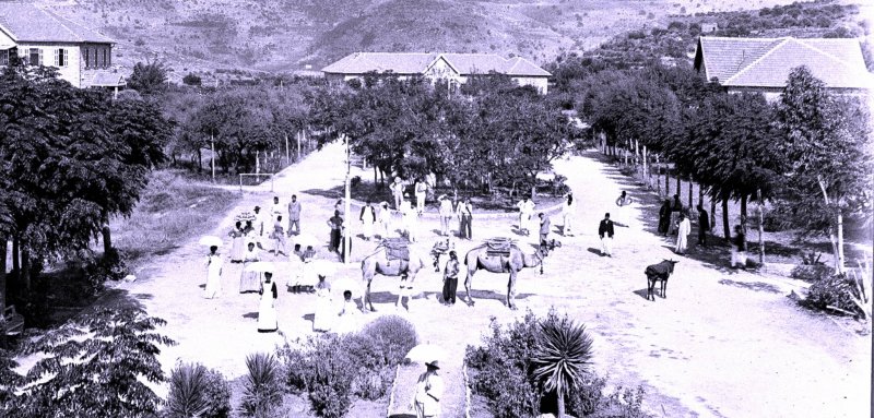 عن جراح خفيّة على الدماغ لم تلتئم منذ 100 عام