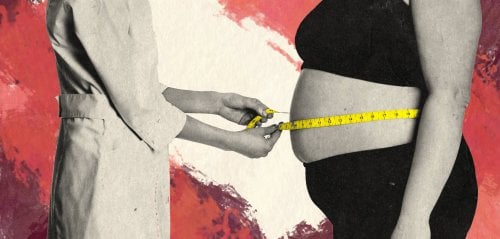 خسارة الوزن مقابل الاكتئاب... معضلة جراحات السمنة
