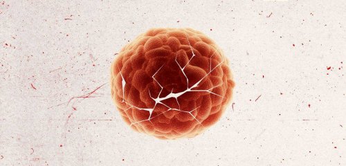 نتائج مبشّرة لعلاج ولقاح جديدين… هل يقترب العلم من الانتصار على السرطان؟