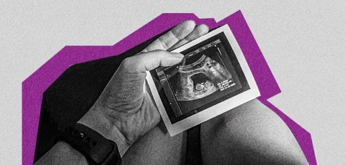 أصبحت أماً لكلّ الأجنّة المجهضة في محيطي