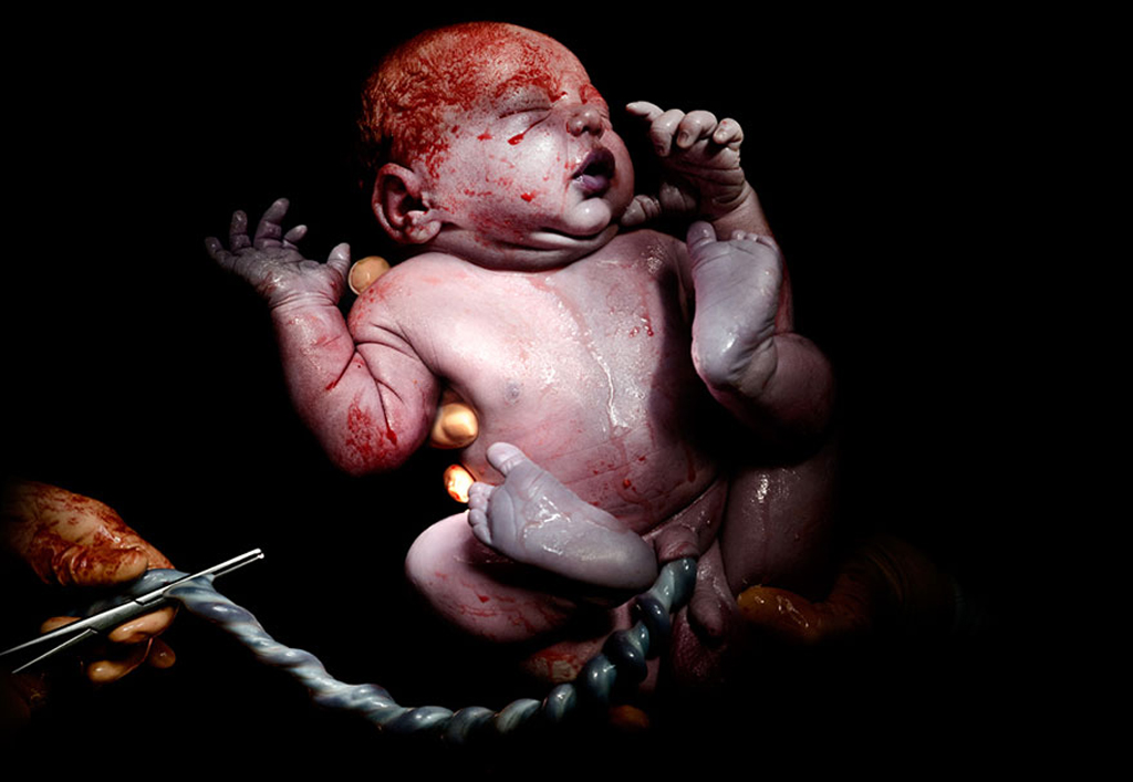 مصور يلتقط صوراً "صادمة" لأطفال بعد ثوانٍ من الولادة