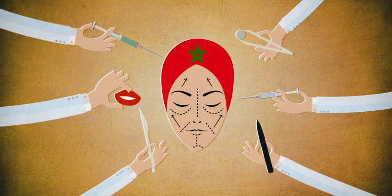 المغاربة من أكثر الشعوب إقبالاً على عمليات التجميل