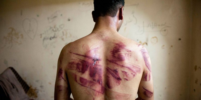 التعذيب، وسيلة الأنظمة العربية المفضلة لقمع معارضيها